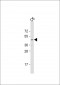 GSK-3B (Thr390) Antibody